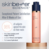 Skinbetter Techno Neck Perfecting Cream